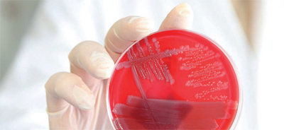 Immagine del batterio Escherichia coli